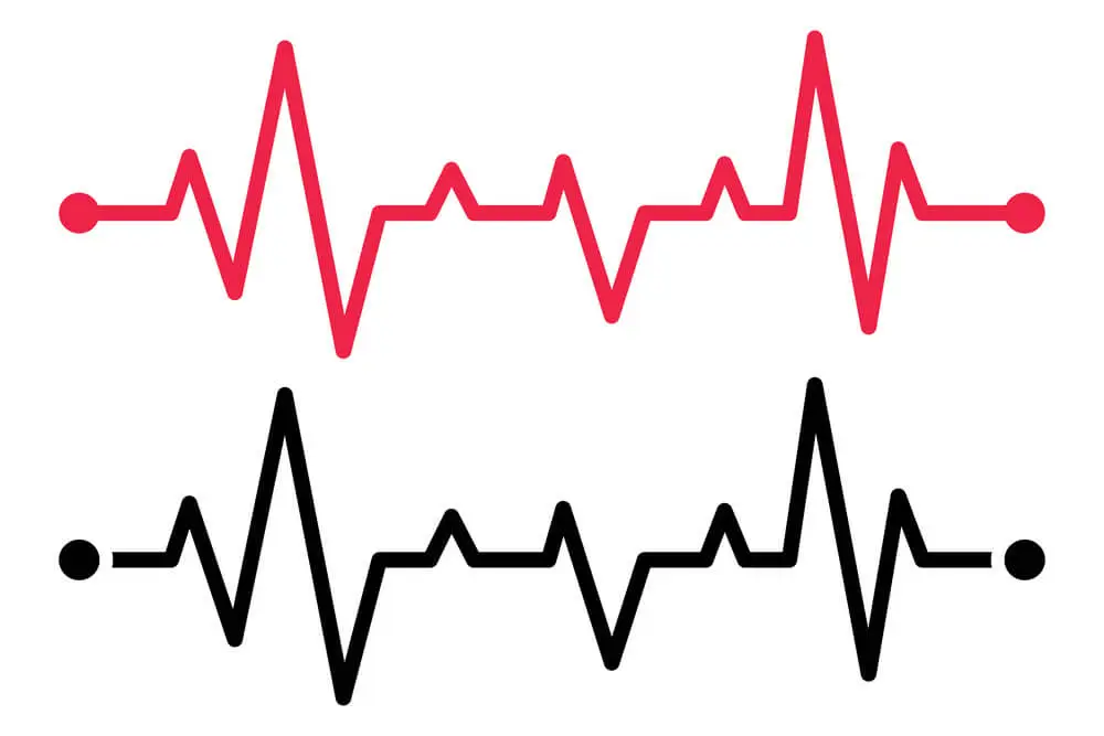 EPS RFA Cardiac Treatment 